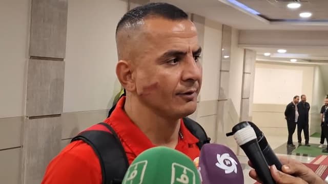 صحبت‌های حامد لک بعد از بازی با ذوب آهن و زخم وحشتناک روی صورتش