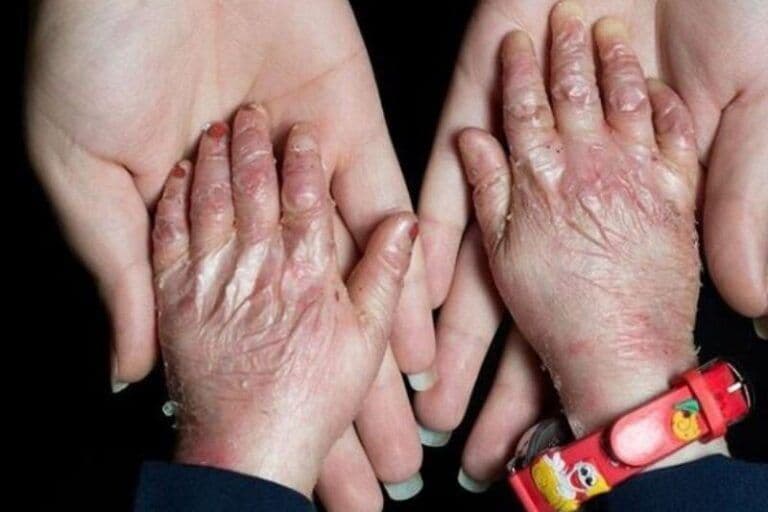 حدود ۲ میلیون بیمار خاص و صعب‌العلاج تحت پوشش بیمه‌ پایه هستند