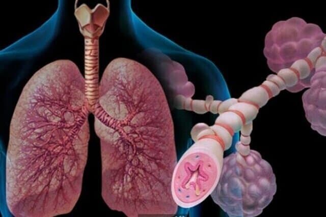 توصیه حیاتی به مبتلایان آسم؛ شهریور این واکسن را تزریق کنید