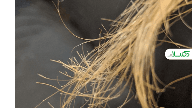 علت‌های اصلی ایجاد موخوره و راهکارهای علمی پیشگیری از آن