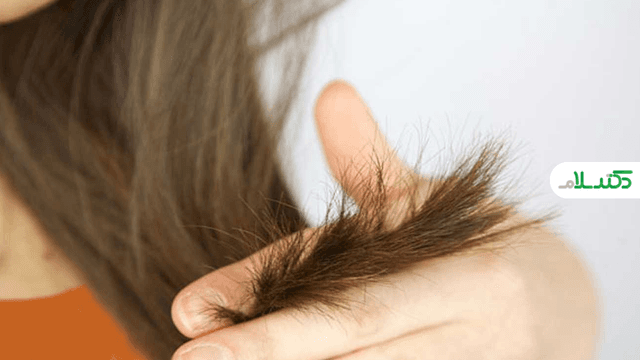 آیا موخوره باعث ریزش مو می‌شود؟