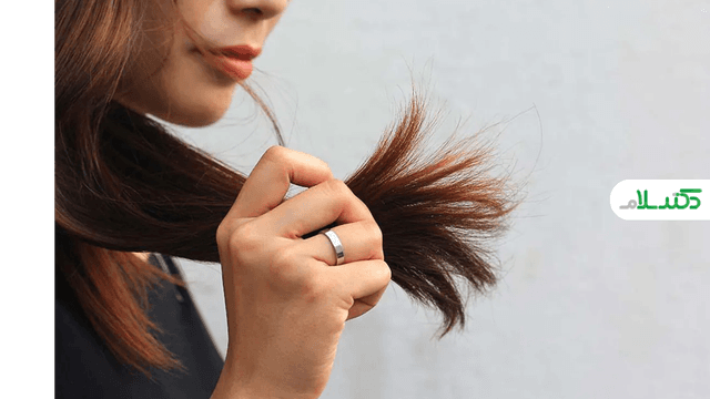بهترین روش‌های پیشگیری از موخوره و حفظ سلامت موها