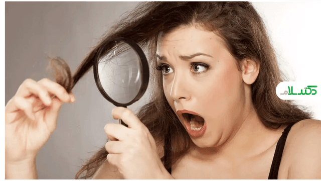 ارتباط بین استرس و آسیب‌دیدگی مو و ایجاد موخوره