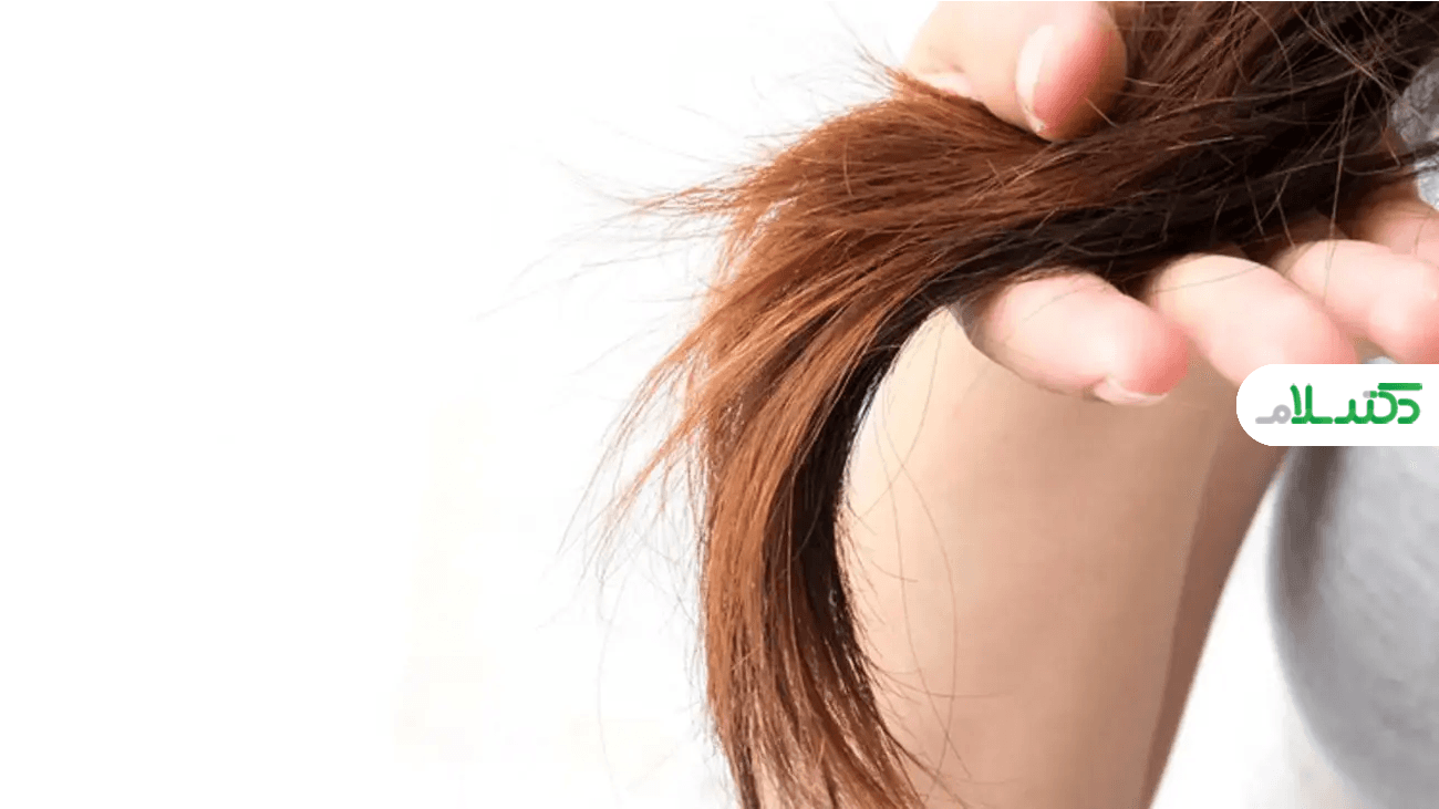 آیا ژنتیک در ایجاد موخوره نقش دارد؟