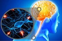 بحران‌های شدید روحی، می‌تواند نقطه‌ شروعی برای فعل‌وانفعالات بیماری‌ ام‌اس باشد