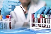 سیستم‌های نظارتی و دقت آزمایشگاه‌ها باید تقویت شود