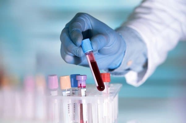 تاثیر آزمایش خون مبتنی بر DNA بر درمان سرطان گلو